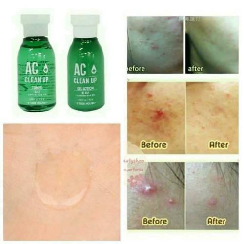 etude-house-ac-toner-serum