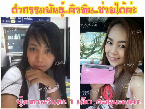 cutin-ลดปัญหาผิวคล้ำ-ไม่เรียบเนียน