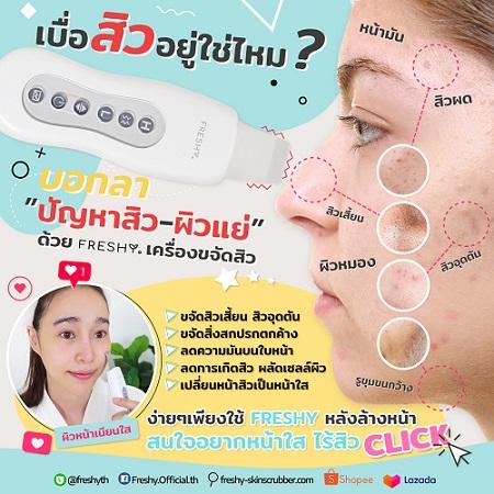 freshy-ตัวช่วยดูแลผิวหน้า-ให้ห่างไกลปัญหาสิว