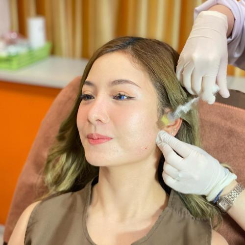 โบท็อกซ์-เหมาๆ