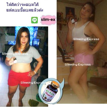 สลิมมิ่ง-เอกเพรส--slimming--express--ลดความอ้วน--ลดพุง--ดื้อ