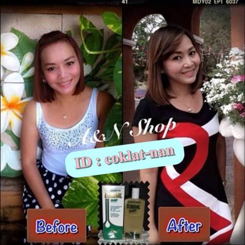 แชมพูพลังม้า-ส่งฟรีตั้งแต่ขวดแรก-ถึง-31-ก.ย.60-เท่านั้น-เร่